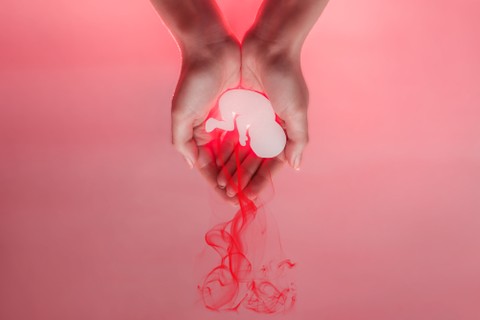 Ilustrasi aborsi. Foto: Shutterstock