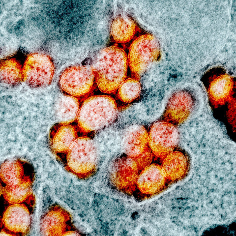 Ilmuwan Australia Temukan Obat Potensial Untuk Bunuh Virus Corona