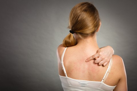 Jerawat punggung Foto: dok. Thinkstock