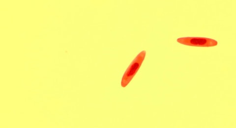 iIustrasi cacing parasit.  Foto: Journal of Invertebrate Pathology