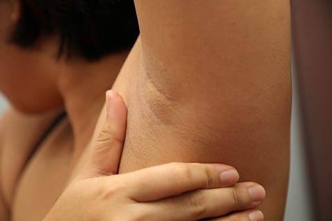 Ilustrasi ketiak. Foto: Shutter Stock