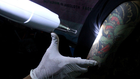 Tato Salib di Tubuh Pria Ini Mendadak Hilang, Ternyata Idap Kondisi Medis Langka