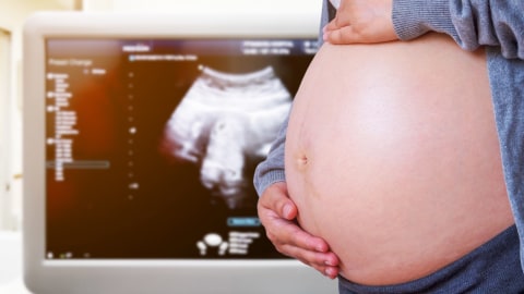 Kamus Kehamilan: USG, Singkatan dari Apa?