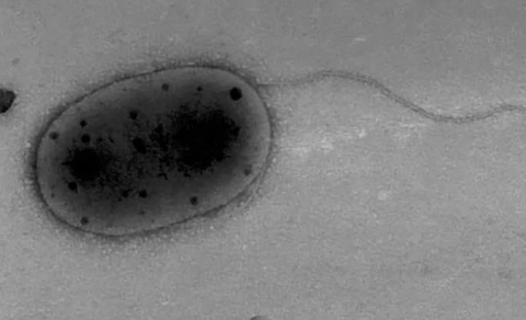 Bakteri Ini Diam-diam Berhubungan ‘Seks’ di Usus Manusia