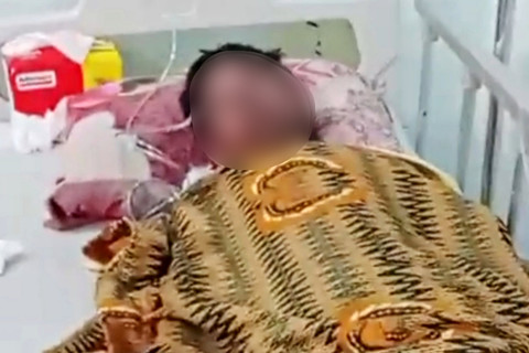 3 Santri di Lombok Tengah Diduga Dibakar Kakak Kelas, 1 Oran