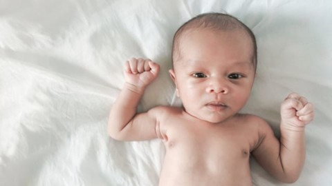tunjuk.id - Ciri-ciri Vitiligo pada Bayi