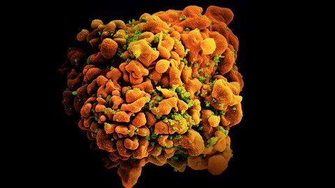 Virus HIV Varian Baru Ditemukan, Lebih Cepat Menular dan Berkembang Jadi AIDS