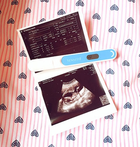 Pengalaman Pcos Ku Yang Berhasil Hamil Alami Kumparan Com Pengalaman Pcos Ku Yang Berhasil Hamil Alami Kumparan Com