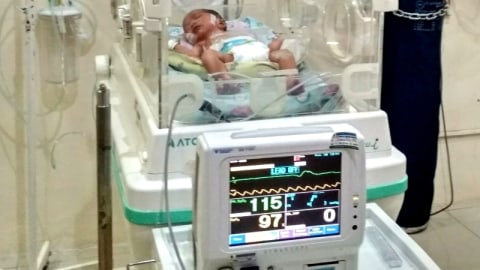 Ilustrasi seorang bayi tengah menjalani perawatanApa itu. Foto: Akhmad Nazaruddin Lathif/ANTARA