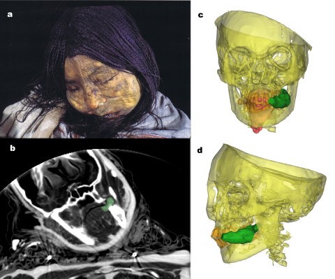 Mumi Llullaillaco Maiden ditemukan dengan benjolan daun koka di mulutnya. Foto: University of Copenhagen