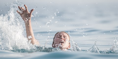 Penyakit Langka Bikin Perempuan Ini Tidur Saat Tertawa (2)
