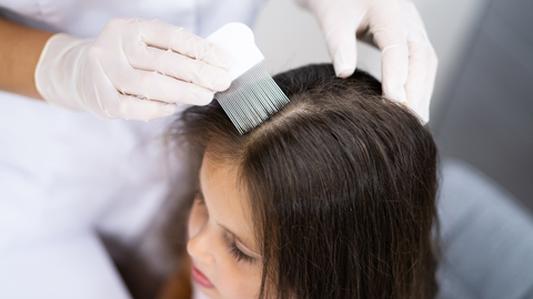 Ilustrasi masalah rambut anak. Foto: Shutter Stock