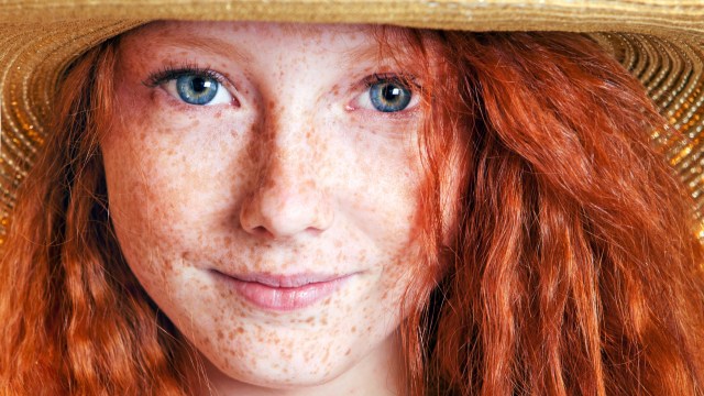 Goodbye flawless, hello freckles! (Foto: Thinkstockphotos)