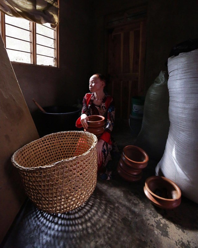 Perempuan albino di Afrika (Foto: Standing Voice/Facebook)