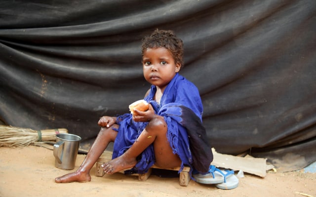 Anak-anak menderita malnutrisi di Yaman (Foto: Reuters)