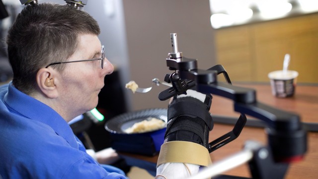 Komputer otak bantu pasien lumpuh (Foto: Case Western Reserve University/Cleveland FES Center/Handout via REUTERS )