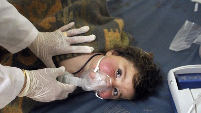 Korban senjata kimia di Suriah. (Foto: AP)