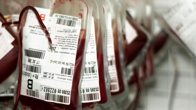 Ilustrasi transfusi darah. (Foto: Thinkstock)