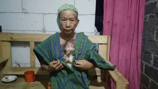 Kondisi Nenek Solimah saat ini (Foto: Anggi Dwiky/kumparan)