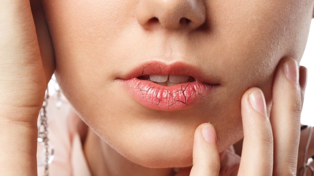Tips untuk mengatasi bibir kering saat berpuasa (Foto: Thinkstock)
