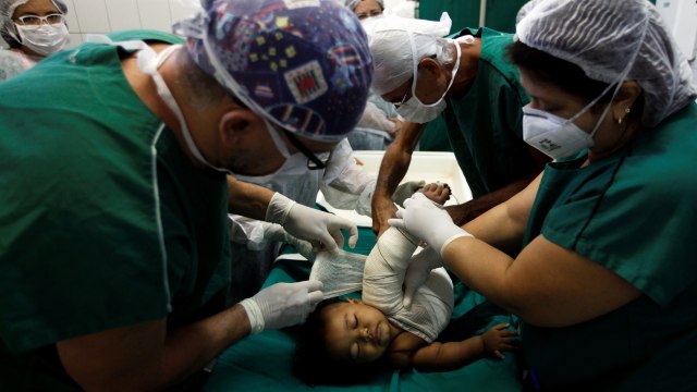 Kulit ikan penyembuh luka bakar (Foto: Reuters/ Paulo Whitaker)