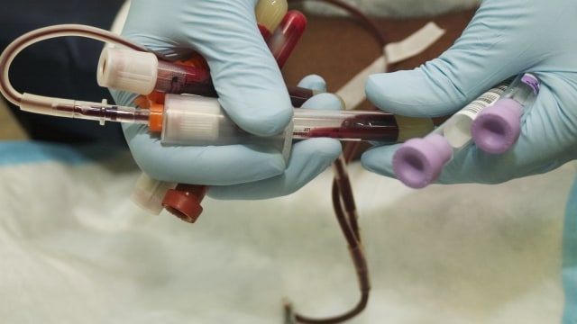 Transfusi Darah dari Wanita Hamil ke Pria Tingkatkan Risiko Kematian (322237)