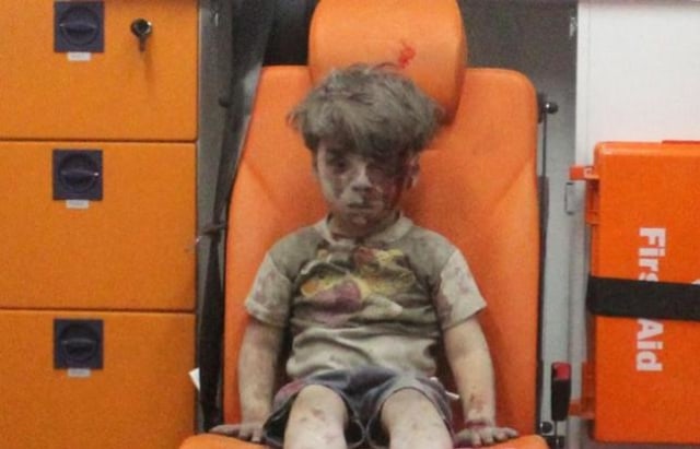 Omran Daqneesh terluka akibat serangan Aleppo. (Foto: Reuters)