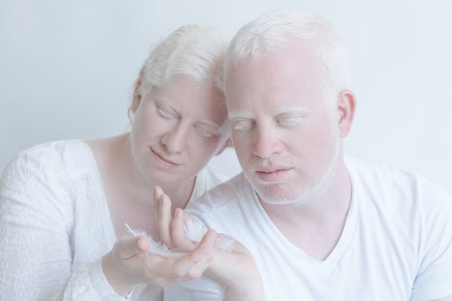 Model albino, Yaron dan Tzlil. (Foto: Dok. yuliataitsphoto.com)