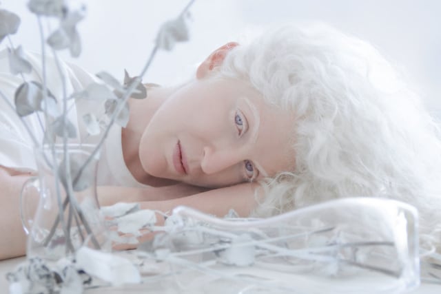 Model albino, Ortal. (Foto: Dok. yuliataitsphoto.com)