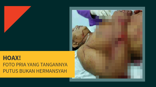 Hoax tangan Hermasyah tidak putus. (Foto: Dok. Istimewa)