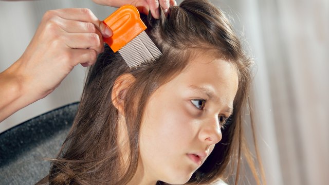 Ilustrasi anak terinfeksi kutu rambut (Foto: Thinkstock)