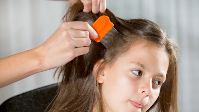 Pengobatan kutu rambut (Foto: Thinkstock)