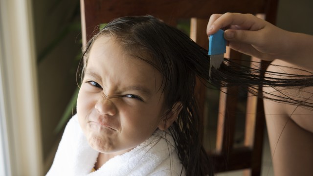 Penanganan kutu rambut (Foto: Thinkstock)