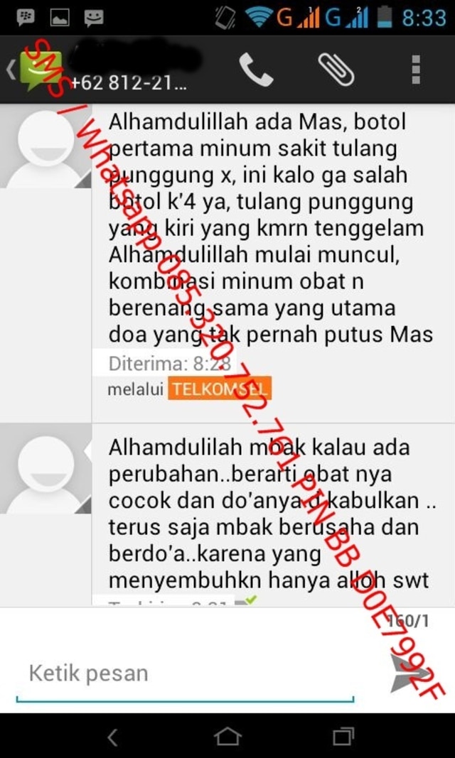 obat skoliosis aman untuk semua usia (1)