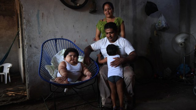 Luis, bayi berusia 10 bulan alami obesitas.  (Foto: PEDRO PARDO / AFP)