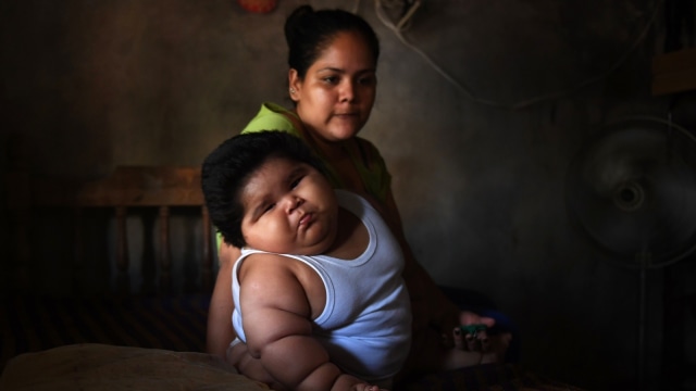 Luis, bayi berusia 10 bulan alami obesitas.  (Foto: PEDRO PARDO / AFP)