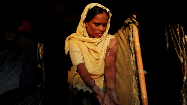 Anwara Begum (36) Warga Rohingya (Foto:  REUTERS/Jorge Silva)