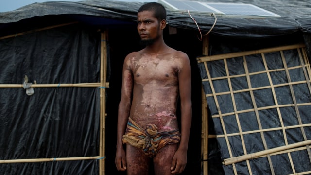Mohamed Jabair (21), Warga Rohingya (Foto: REUTERS/Jorge Silva)