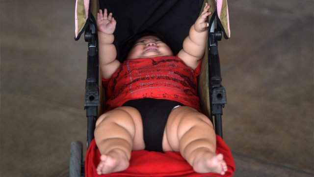 Balita Obesitas di Meksiko (Foto: AFP PHOTO / PEDRO PARDO)