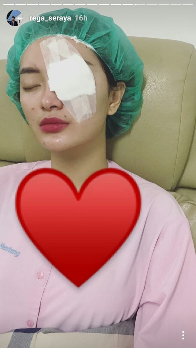 Zaskia Gotik usai operasi mata (Foto: Instagram @rega_seraya)