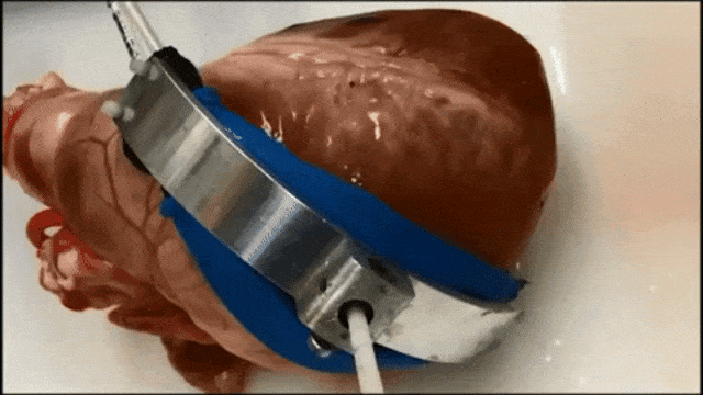 Alat Robotik untuk Atasi Penyakit Jantung (Foto: Robert S. Eshelman/Youtube)