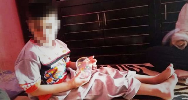 Dikurung 8 Tahun, Bocah Asal Simpenan Kabupaten Sukabumi Ini Sempat Makan Kotoran Sendiri
