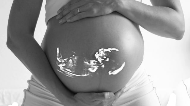 Ibu hamil, waspada perkembangan janin Anda di dalam kandungan. Foto: Pixabay