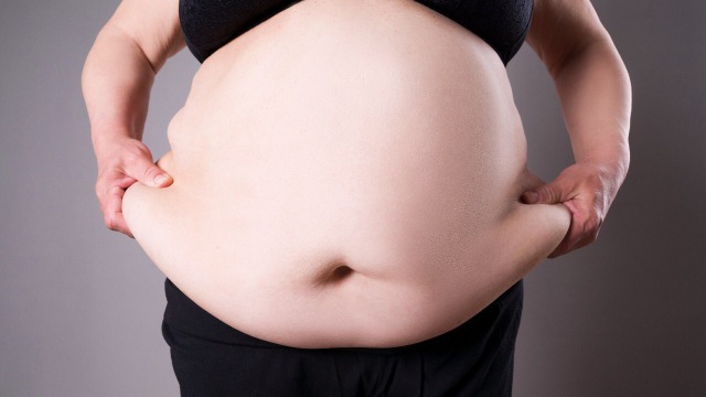Ilustrasi Obesitas (Foto: Thinstock)
