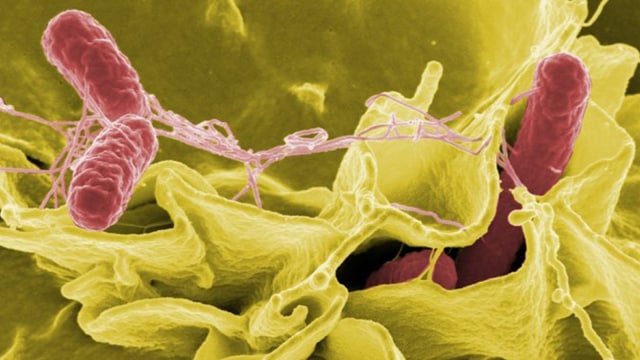 Bakteri Campylobacter (Foto: Pixabay.com)