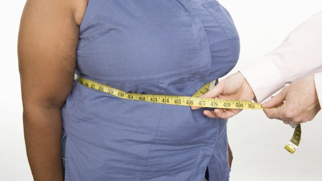 Ilustrasi Obesitas (Foto: Thinkstock)