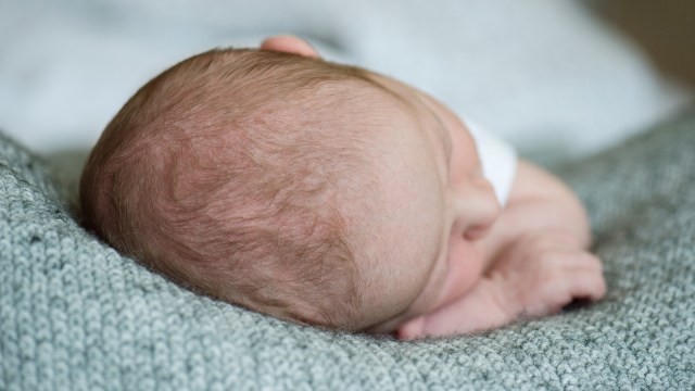 Kepala bayi. (Foto: Thinkstock)