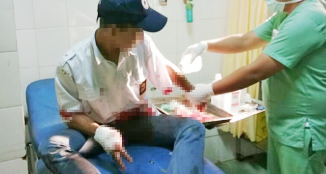 Mengerikan! Jari Tangan Pelajar SMK Dwi Darma Sukabumi Putus Disabet Senjata Tajam