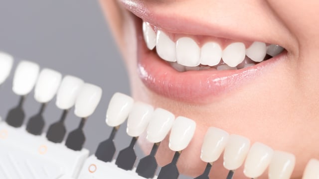 Ilustrasi memutihkan gigi (Foto: Thinkstock)