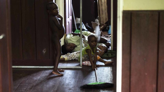 Penderita Gizi Buruk di Asmat (Foto: ANTARA FOTO/M Agung Rajasa)